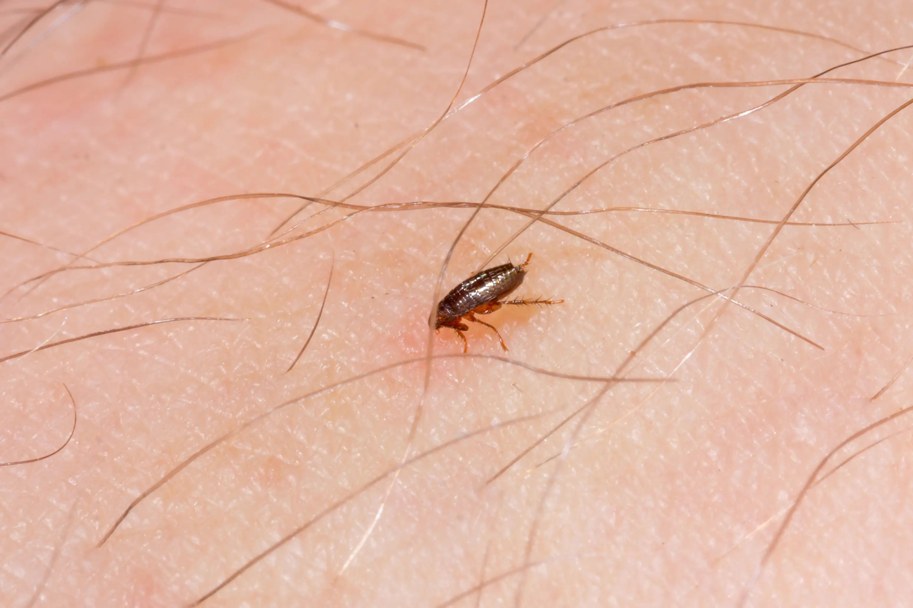 Can Humans Get Fleas from Pets? Flea Bites & Treatment